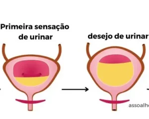 Bexiga urinária